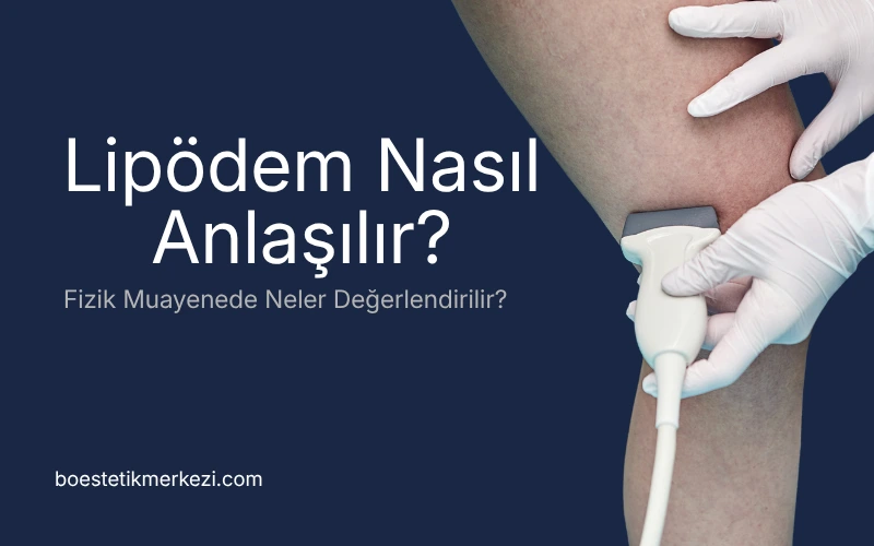Lipödem nasıl anlaşılır - tanı süreci adım adım